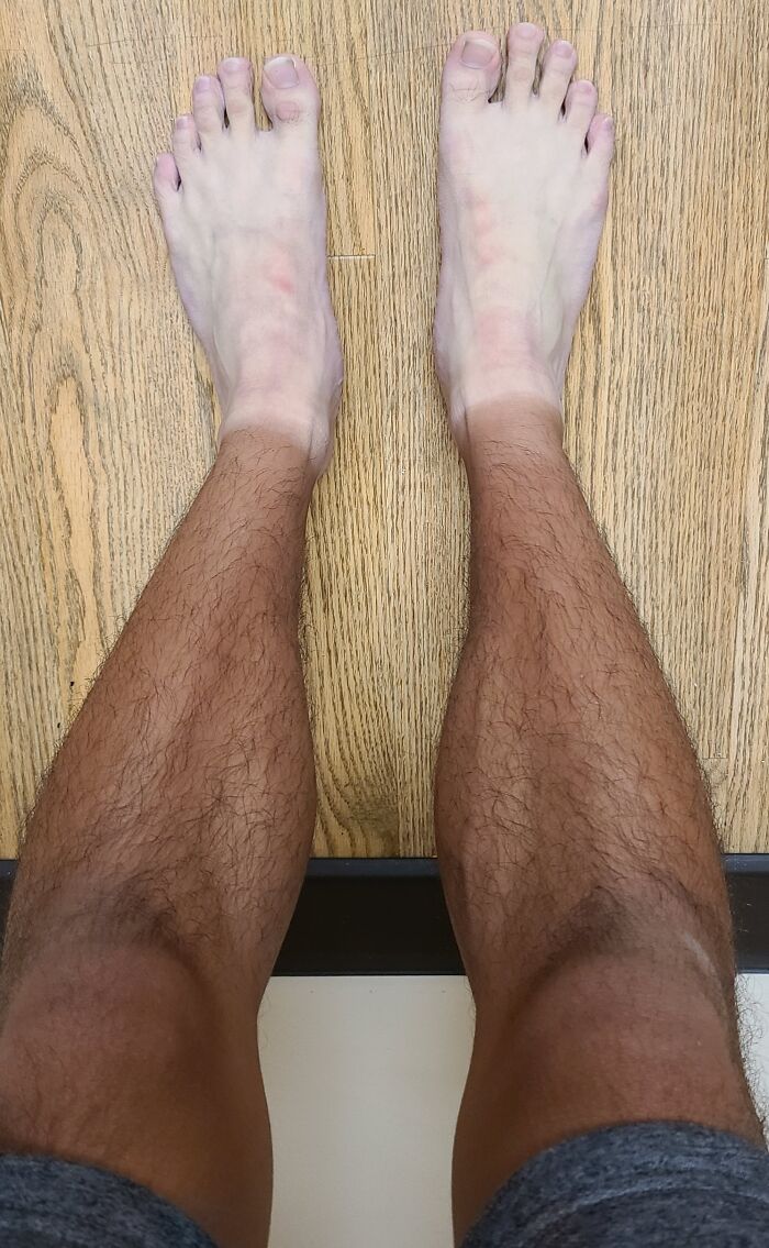 My Sock Tan Looks Like I Have Socks On