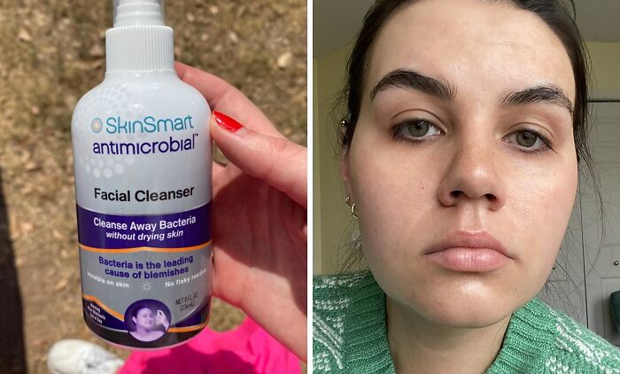 This Skinsmart Facial Cleanser Is The Bacteria-Blasting Bodyguard Your Thirty-Something Skin Has Been Begging For