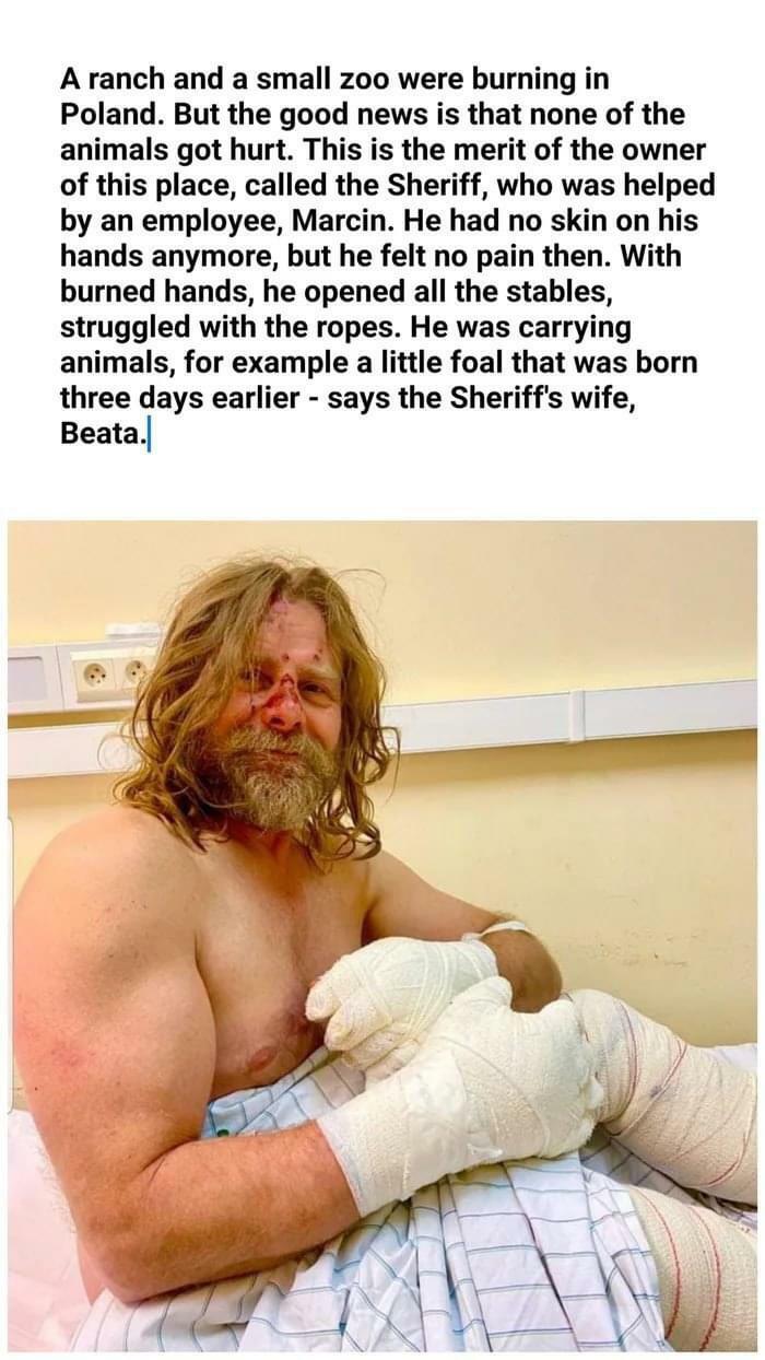 This Legend Called Marcin Took Serious Burns To His Hands To Save Animals At A Zoo