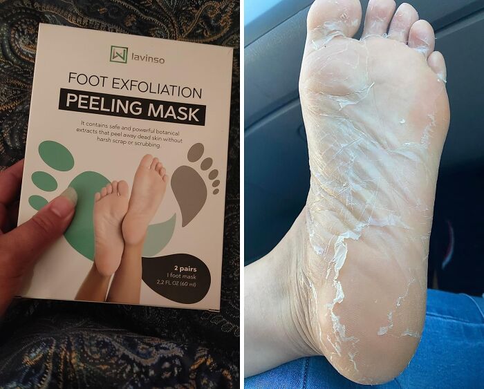 Your Feet Deserve A Spa Day, And This Foot Peel Mask Is Your Ticket To Baby-Soft Skin! 