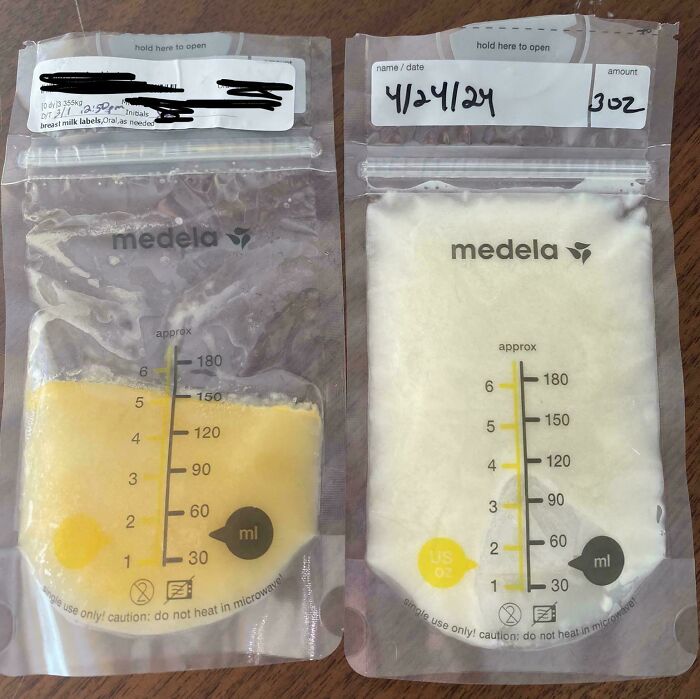 Breast Milk's Color Difference 3 Days Postpartum vs. 8 Weeks Postpartum