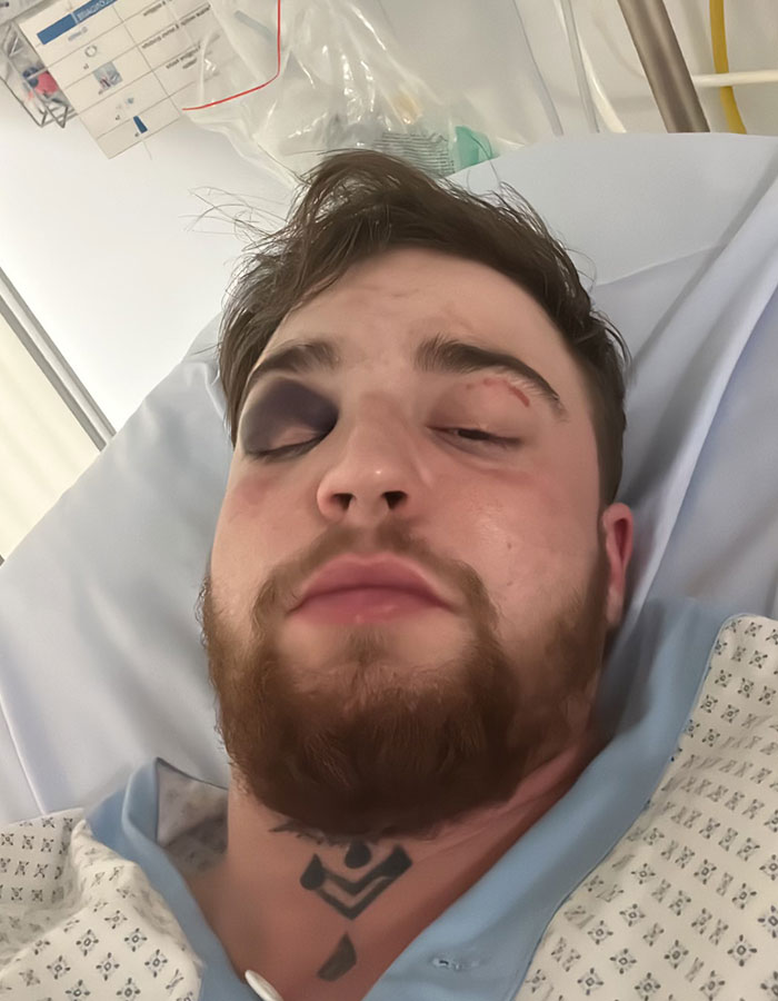 29-Year-Old Trans Man Gets Brutally Beaten Up In Switzerland, Claims It’s A Hate Crime