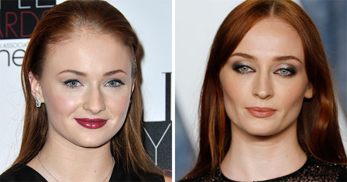 What 14 Famous Stars Looked Like Before Their Stunning Cheekbone Transformations