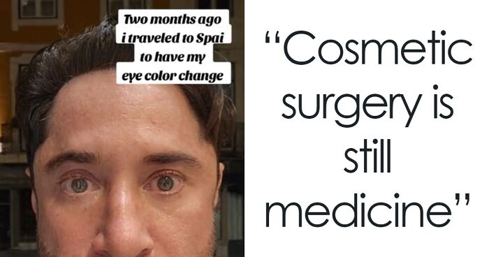 The Most Dangerous Cosmetic Procedure Is The “Trending” Eye Color-Change Surgery