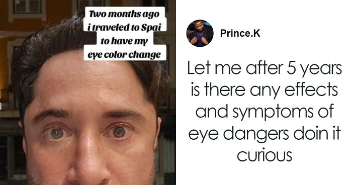 People Undergo Surgery To Permanently Change Their Eye Colors Despite “Extreme” Risk