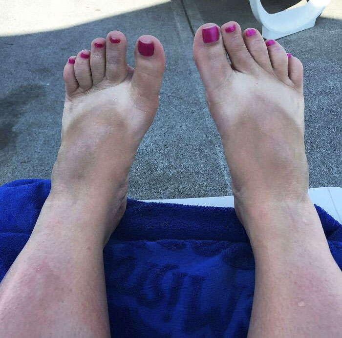 Note To Self: Remove Sandals Before Tanning Next Time