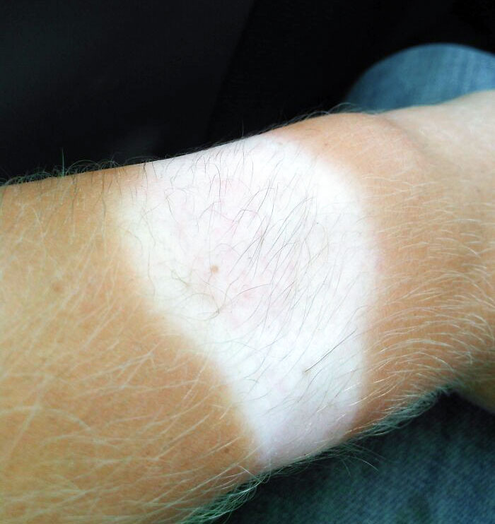 The Hair On The Pale Part Of My Watch Tan Is Black, But The Hair On The Tan Part Of My Arm Is White