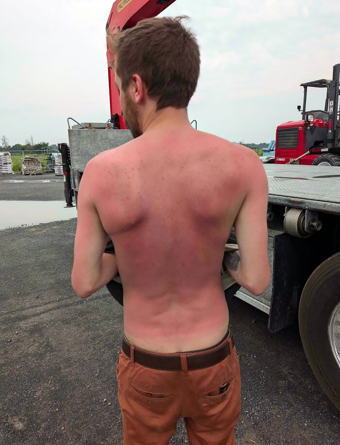 Thought I Would Get A Nice Base Tan Helping Out At My Customer's Farm For A Couple Hours