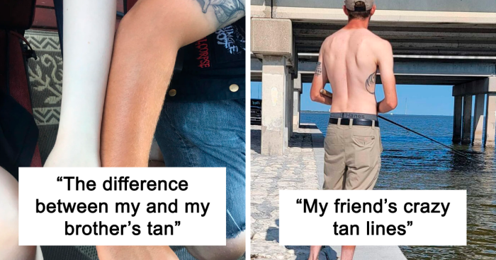 74 Times Sunbathing Turned Into A Painful Fail For These People (New Pics)