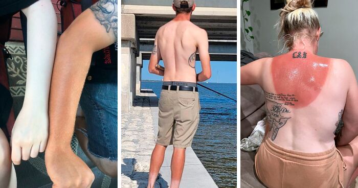 74 Times People Posted Their Embarrassing Sunbathing Fails So You Can Learn From Their Mistakes