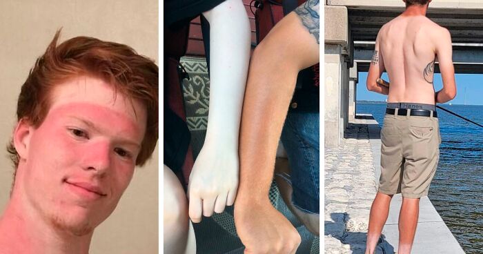 74 Times People Wished They’d Put Sunscreen On (New Pics)