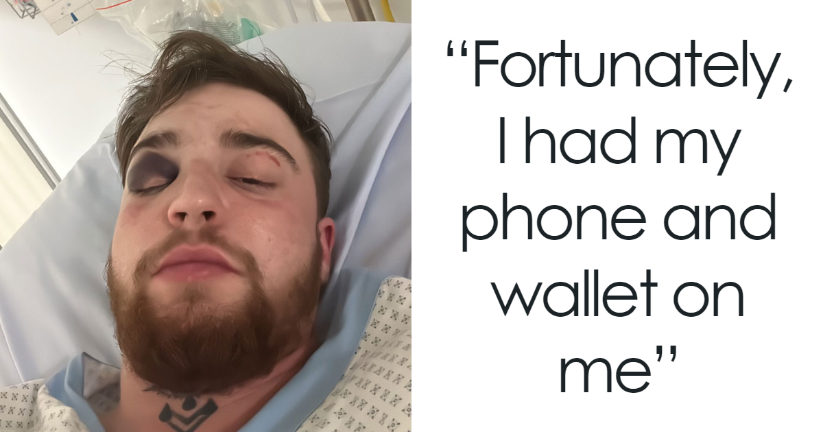 Trans Influencer Brutally Beaten Up In Switzerland, Claims It Was A Hate Crime (EXCLUSIVE)