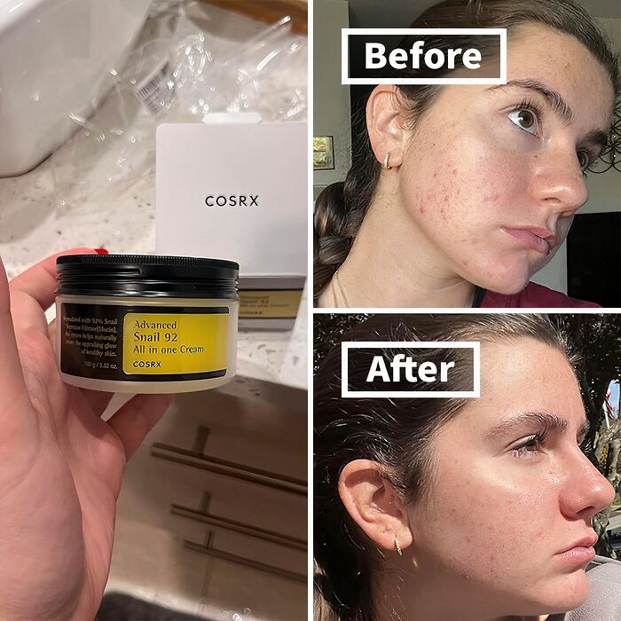 This COSRX Snail Mucin Cream Is The All-In-One Solution For Dry, Acne-Prone, And Sensitive Skin, Delivering Deep Hydration And Gentle Repair