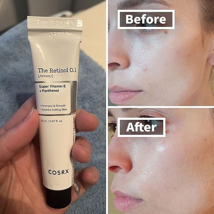  COSRX Retinol Cream Is Your Skin's Time Machine, Turning Back The Clock On Wrinkles And Fine Lines