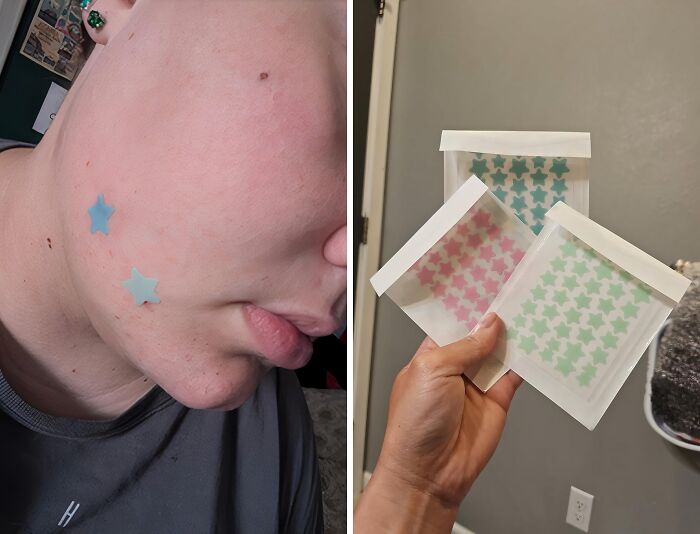 These Star Pimple Patches Are The Celestial Solution To Your Breakout Blues, Turning Those Pesky Pimples Into A Constellation Of Cuteness