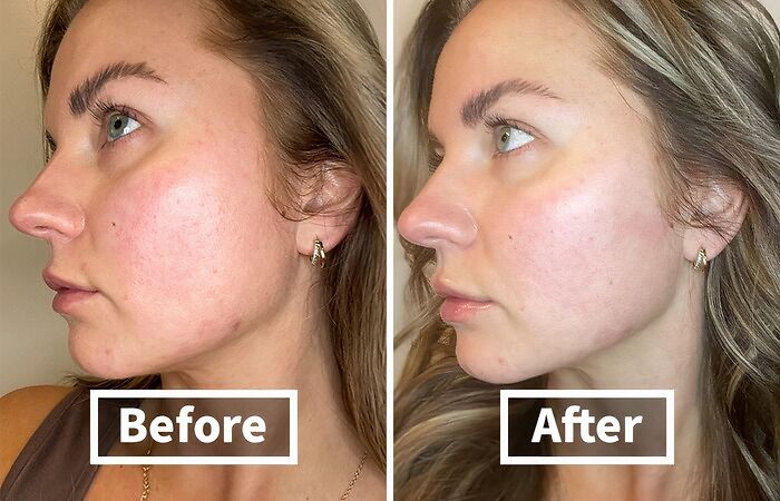 Before: Dry, Lackluster Skin Showing The Signs Of Aging After: Face Moisturizer Collagen Cream Works Its Magic, Plumping And Hydrating Your Skin For A Youthful, Radiant Glow