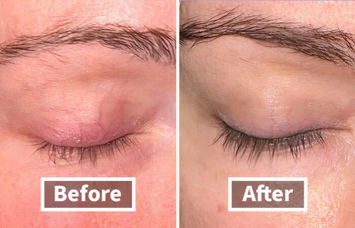 Before: Short, Sparse Lashes That Barely Make A Statement After: Lash Enhancing Serum Works Its Magic, Transforming Your Lashes Into Long, Luscious Flutterers That'll Have Everyone Batting An Eye