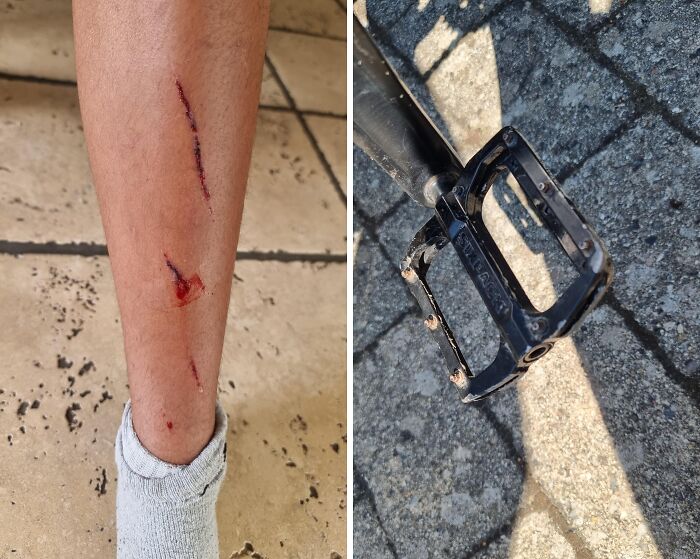 "Wear your shin guards mountainbikers" - Ok-Perspective1524