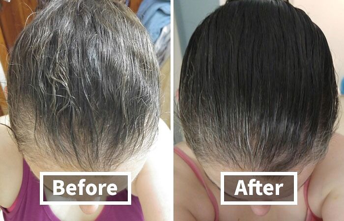 Thinning Hair Got You Down? Don't Surrender To The Struggle! 