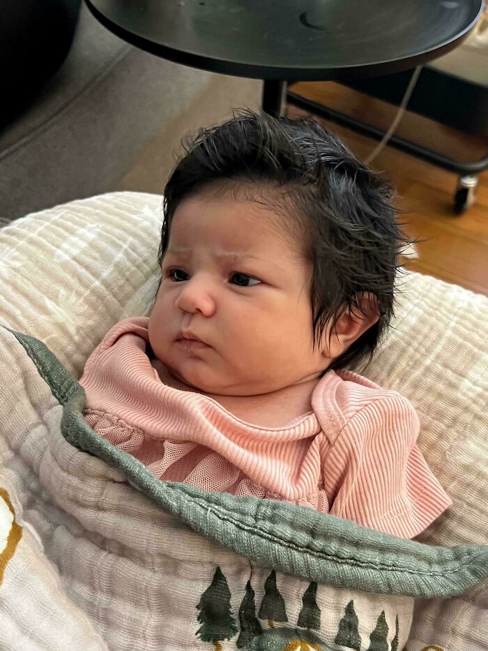 Our Daughter Was Born With A Lot Of Hair