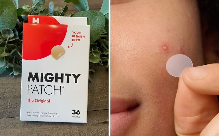 Pimples Popping Up At The Worst Possible Time? Mighty Patch Is Here To Save The Day (And Your Selfie)