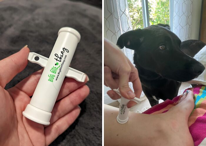 Itch, Begone! This Bug Bite Thing Suction Tool Will Suck The Life Out Of Those Pesky Bites, Leaving You With Sweet Relief 