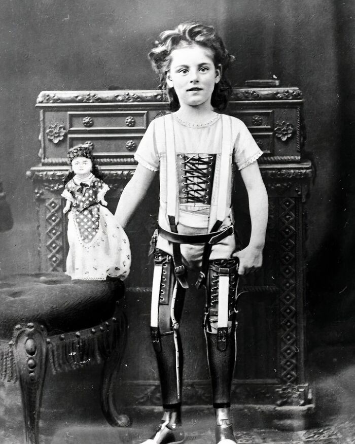 Young Girl Wearing Prosthetic Legs, England, 1890-1910