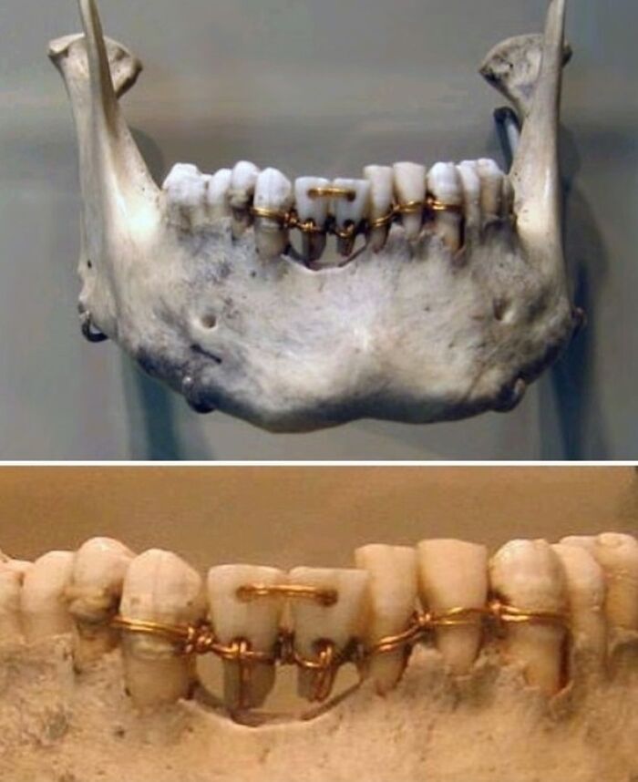 A Whopping 4,000 Years Ago, Ancient Egyptians Were Performing Sophisticated Dental Work That Remains Astounding Even Today