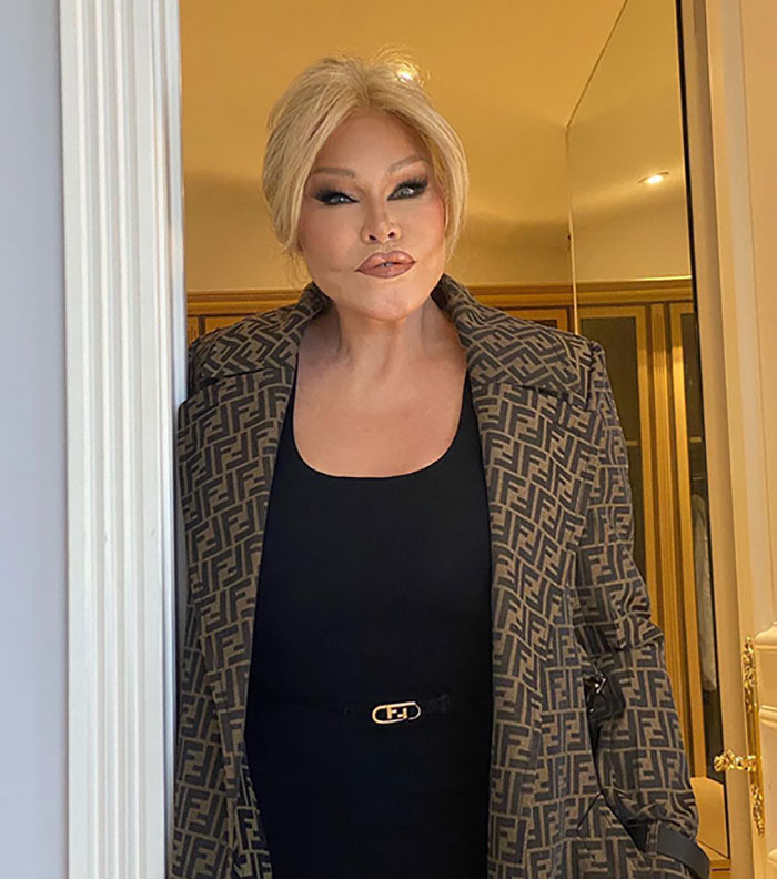 ‘Catwoman’ Jocelyn Wildenstein Reveals Her Original Face In Stunning Throwback Post