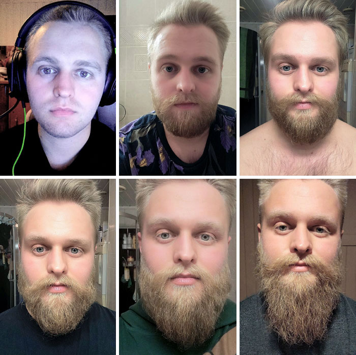 My 8-Month Beard Journey