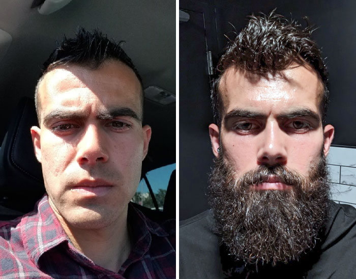 Started Growing A Beard As A Way To Heal Myself. Here's 5 Months Progress