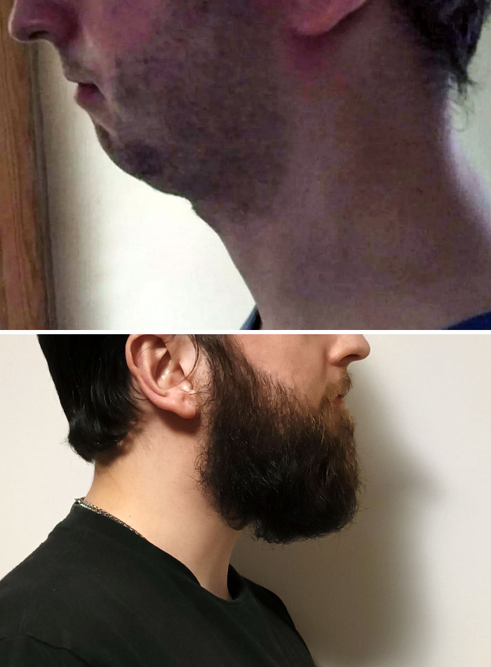 I Guess I Will Keep The Beard For The Rest Of My Life