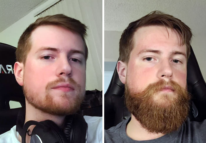 The First Real Attempt At Growing A Beard