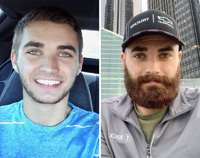 19-Year-Old Me Without A Beard vs. 23-Year-Old With A Beard