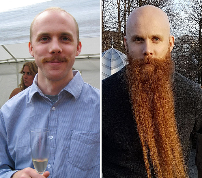 Before And After Growing A Beard