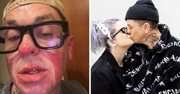 Kelly Osbourne Issues Warning After Boyfriend, Slipknot’s Sid Wilson, “Set Himself On Fire”