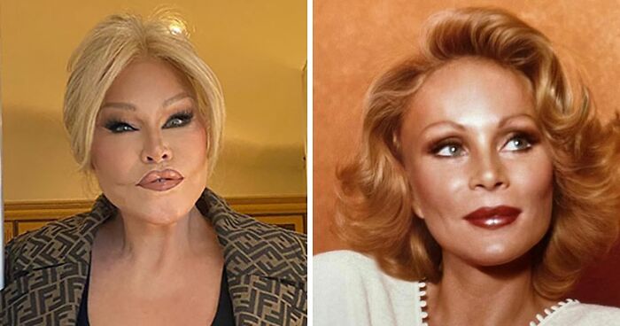 ‘Catwoman’ Jocelyn Wildenstein Reveals Her Original Face In Stunning Throwback Post