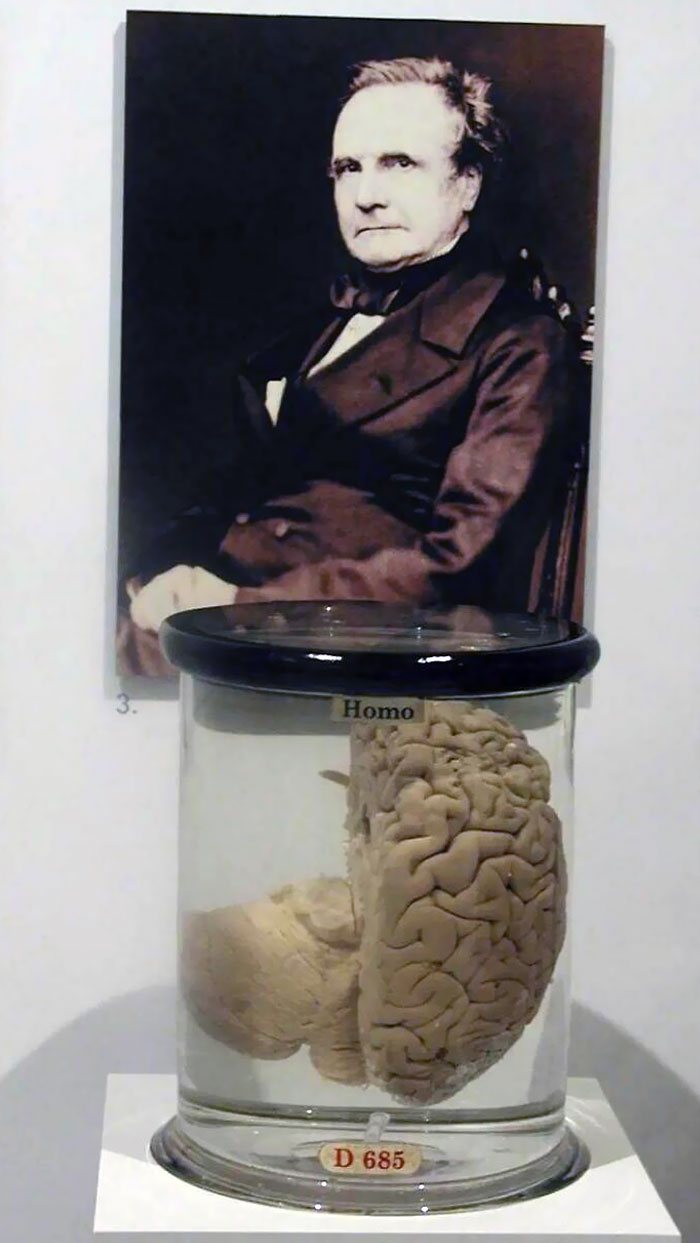 Half Of Charles Babbage’s Brain Is Displayed At The Science Museum, London (The Other Half Is At The Hunterian Museum, Also London)