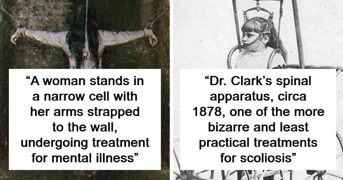 30 Medical Treatments That You'll Probably Be Glad Are In The Past