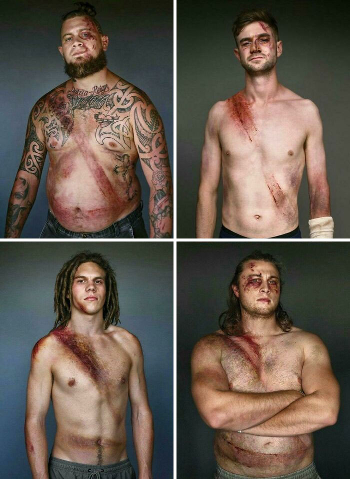 A Photoshoot Of Car Crash Survivors For A New Zealand Road Safety Campaign To Demonstrate How Seat Belts Saved Their Lives