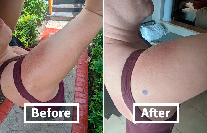 Forget The Guesswork! SPF Sensing Stickers Will Let You Know Exactly When Your Sunscreen Is Losing Its Mojo