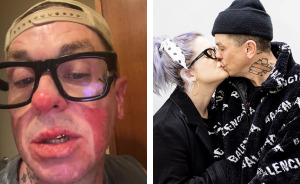 Kelly Osbourne Issues Warning After Boyfriend, Slipknot’s Sid Wilson, “Set Himself On Fire”