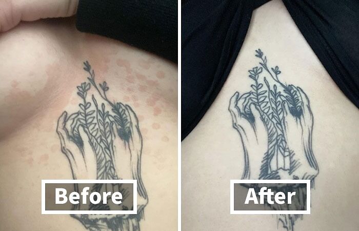 Tattoo transformation before and after, ideal for delivery in a plain brown box.