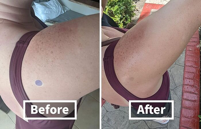 Sun's Out, Fun's Out, But These Sunscreen Detection Stickers Will Keep The Burn Out