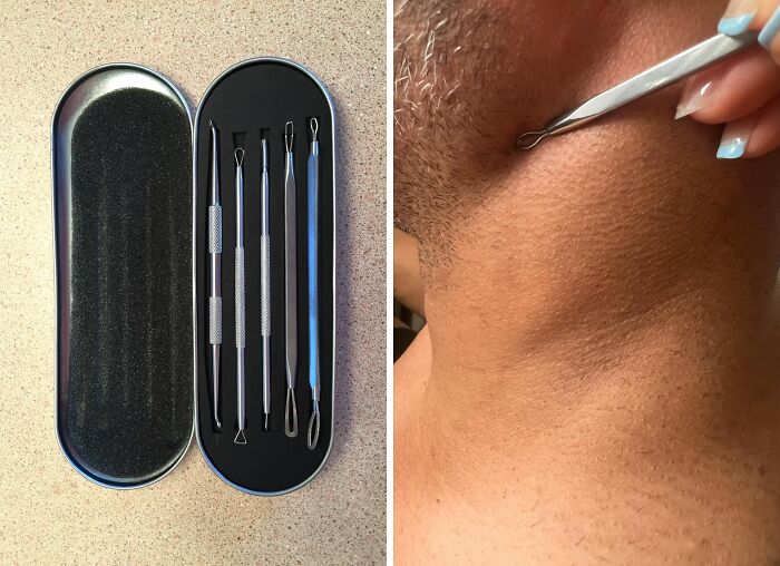 This Blackhead Remover Tool Is So Satisfying To Use, You Might Just Find Yourself Looking For Blackheads You Didn't Even Know You Had