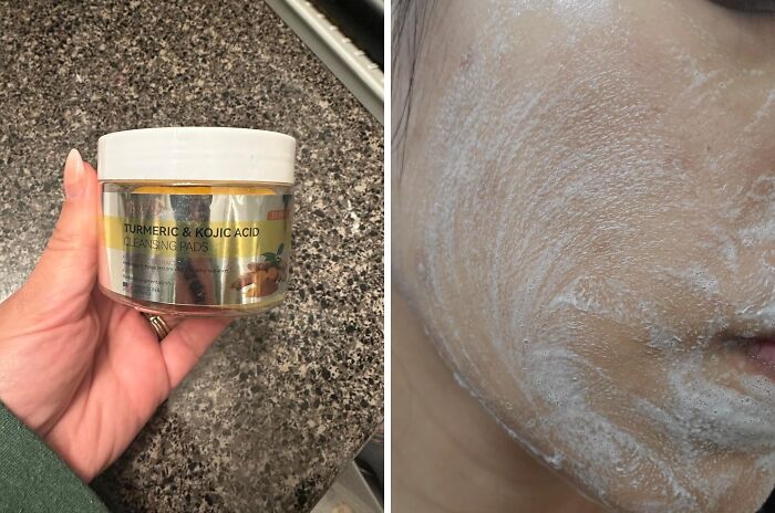  Turmeric Cleansing Pads? Heck Yeah, Welcome To That Glow Life