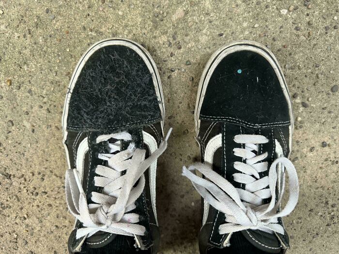 My Left Shoe Has Developed A Fuzzy Texture Over Time Despite Having The Same Number Of Wears As My Right Shoe