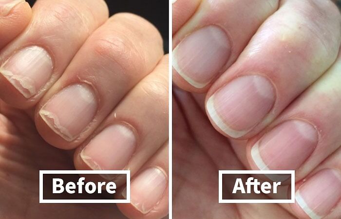 Ditch The Hangnails And Embrace The Nail-Vana With This Miracle-Working Cuticle Oil!