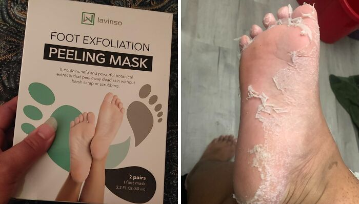 Calluses And Cracks, Be Gone! This Foot Peel Mask Is The Shedding Solution Your Feet Have Been Waiting For