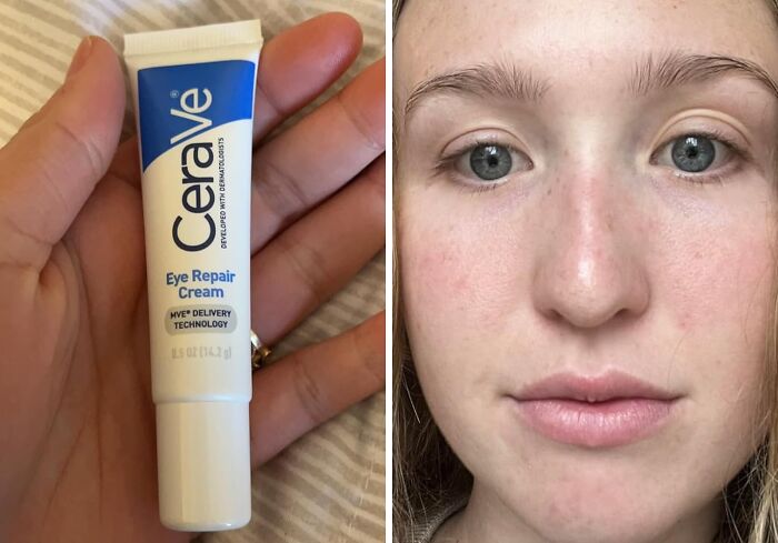 Say Goodbye To 'Raccoon Eyes' And Hello To A Well-Rested Look!" This CeraVe Eye Cream Tackles Dark Circles And Puffiness Like A Boss, Leaving You Looking Bright-Eyed And Bushy-Tailed 